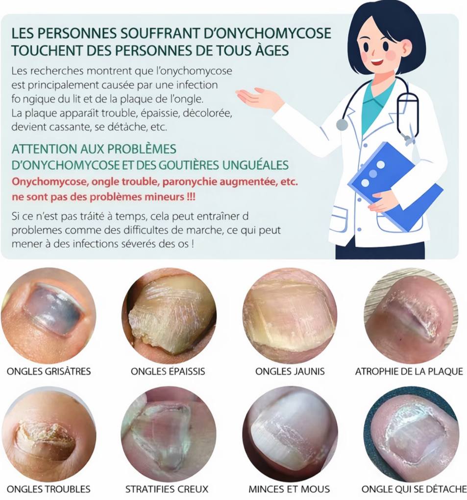 ⭐⭐⭐⭐⭐ +257 avis clients  MycoClean Pro , Reprends le contrôle face aux mycoses.